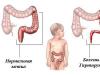 Symptoms, causes in children and adults