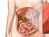 Cholecystitis - what it is, causes, signs, symptoms, treatment in adults, diet and prevention