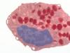 Why are eosinophils elevated in the blood, what does this mean?